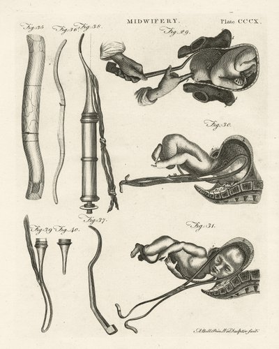 Geburtshilfe, Illustration aus 